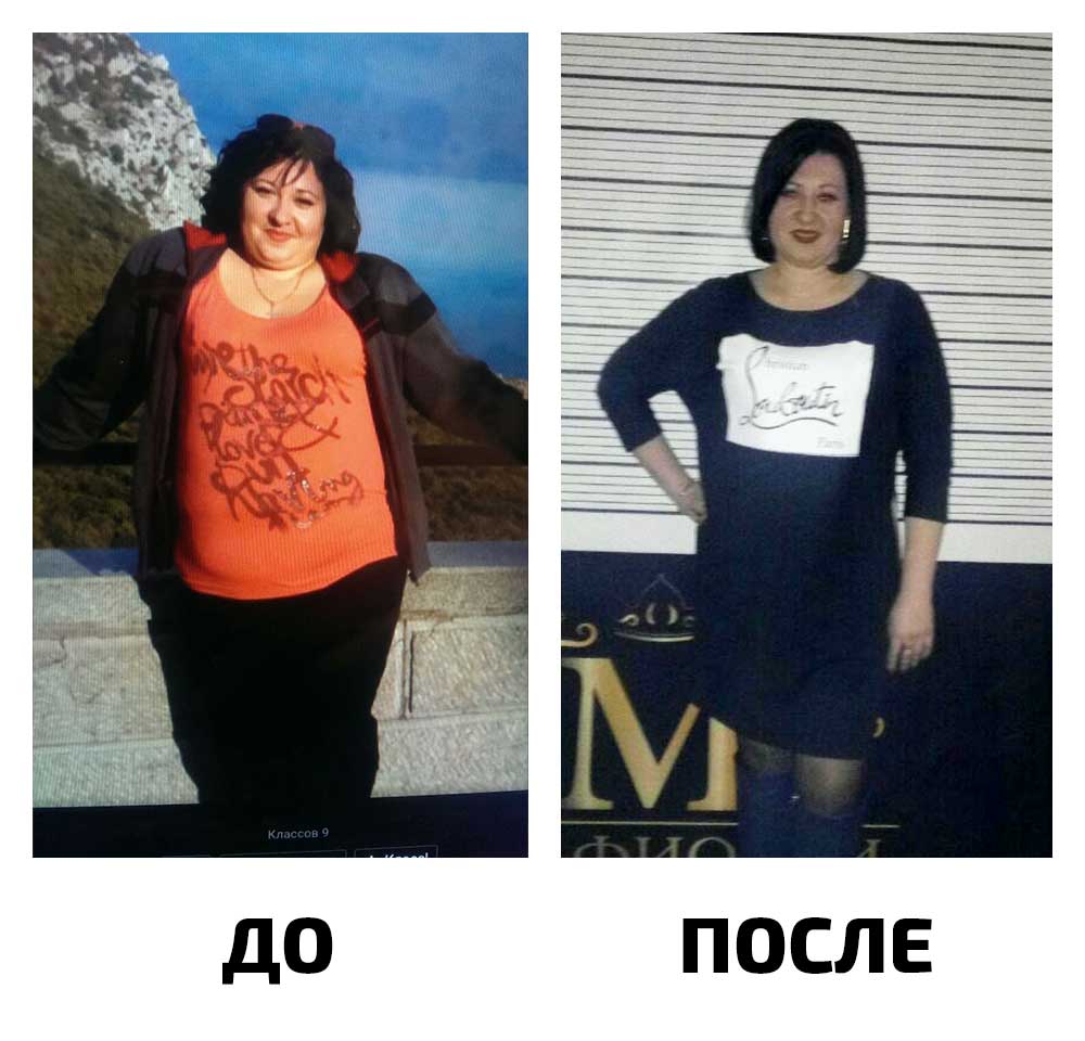 Похудела на 27 кг. До-134 кг, после-107 кг.