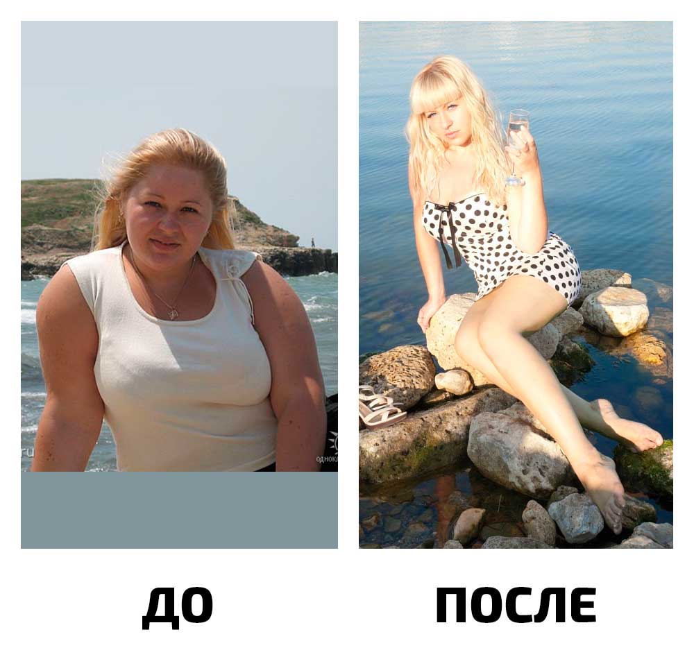 Татьяна,32 года. До 111 кг, после-57 кг. За 1.5 года