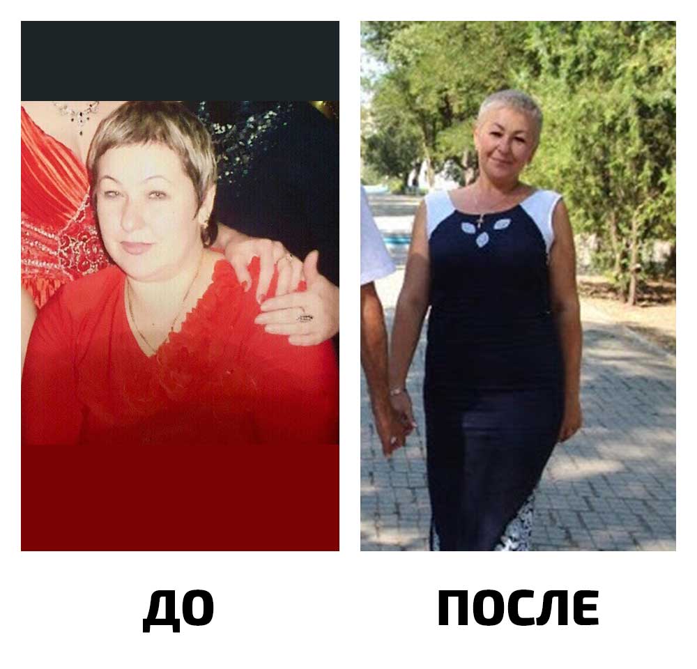 До-103 кг, после-77 кг.